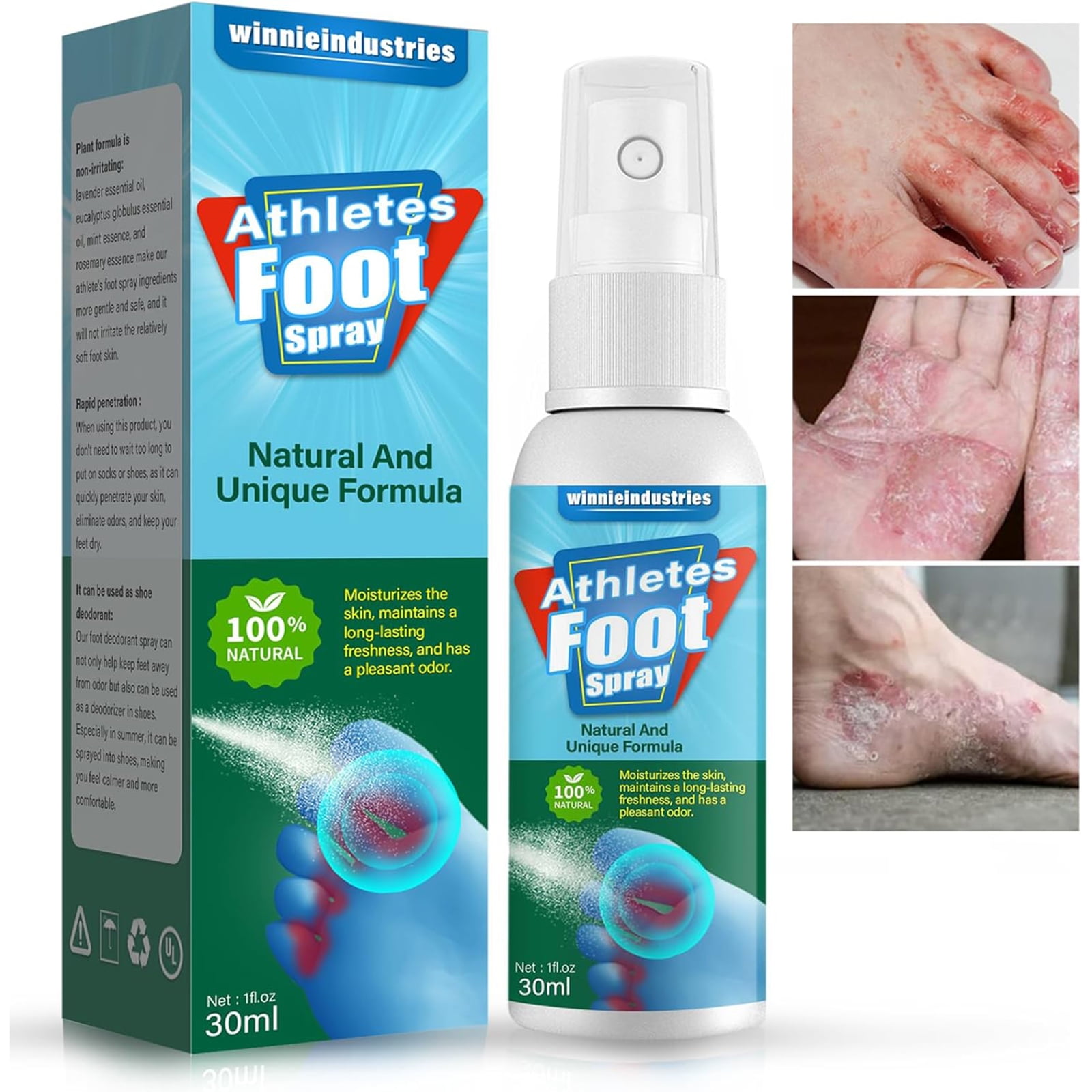 Athletes Foot Spray, Antifungal Spray Athletes Foot Treatment, Anti Fungal Treatment for Feet Itchy, Sweating, Peeling and Blisters, Natural Ingredients Foot Fungal Spray for Tinea Pedis